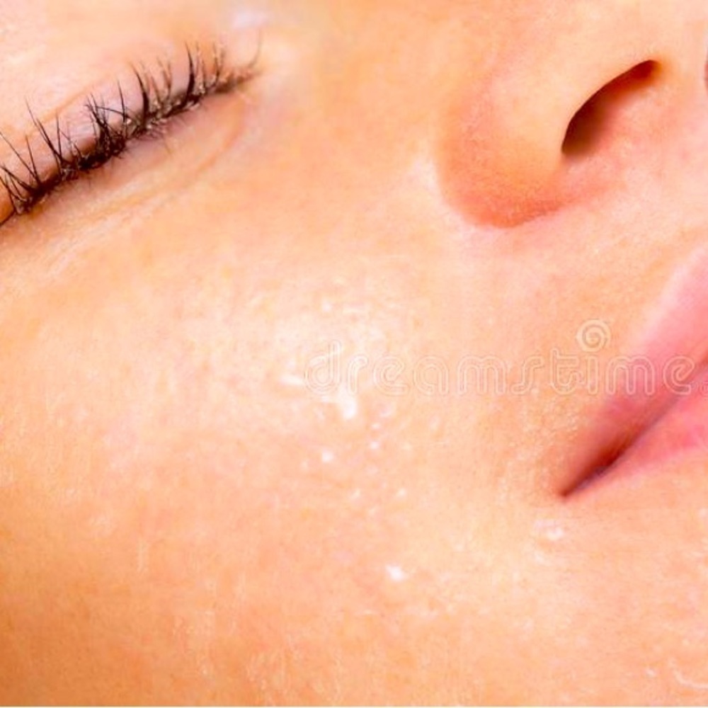 VICHY laboratories liftactiv supreme visible liftinf effect 1.5% hyaluronic acid - Picture 1 of 8